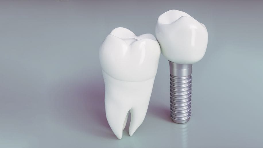 Microhardness of Dental Composites